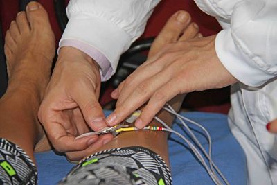 Trata IPN síndrome climatérico con técnicas de acupuntura.